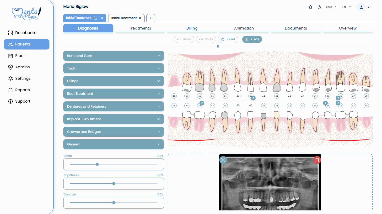 Start With Diagnosis