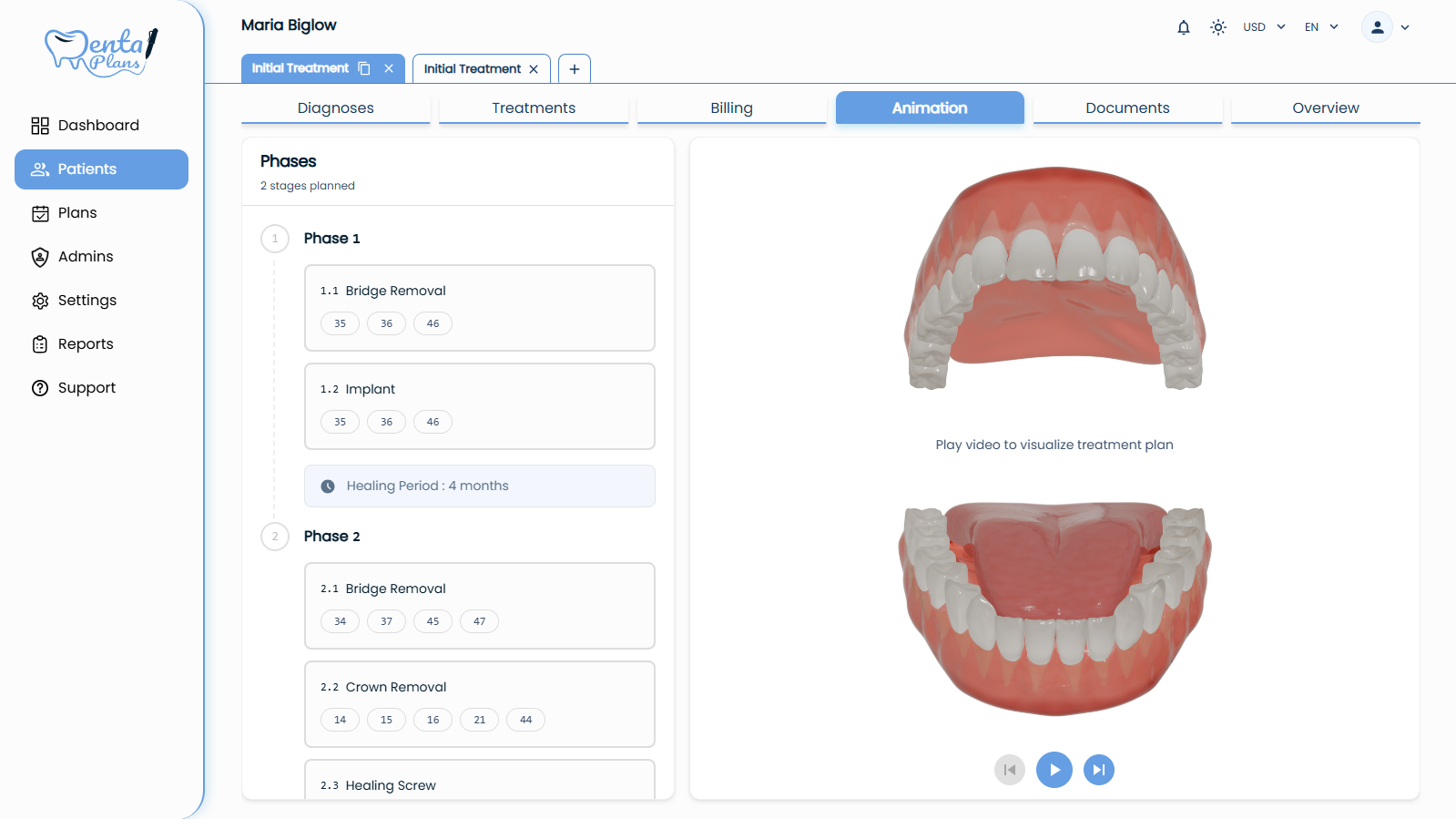 View Treatment Plan (Video)